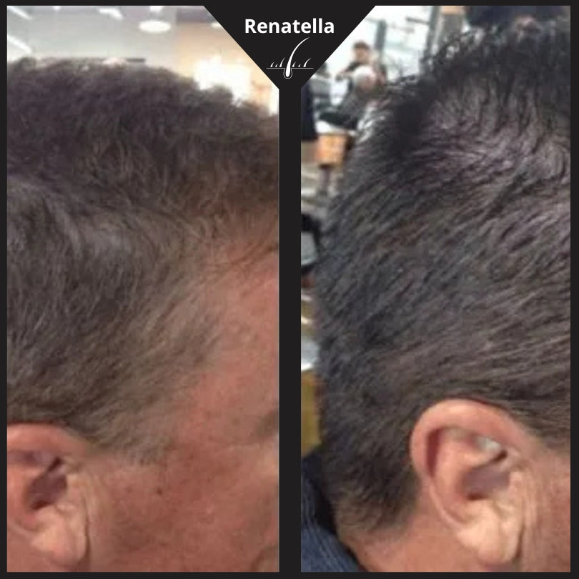RENATELLA™ Restaura tu color natural sin tintes ni químicos
